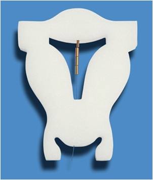 obr. nehormonální tělísko GyneFix